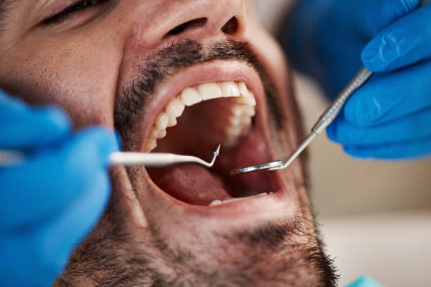 Best Emergency Treatment for Jaw Pain or Injury in Ramtown, NJ