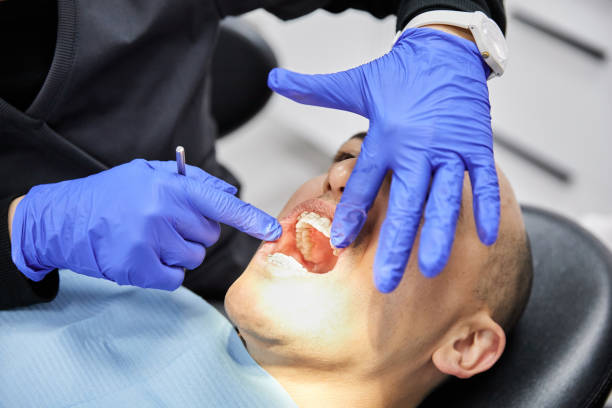 Best Knocked-Out Tooth (Avulsed Tooth) Treatment in Ramtown, NJ